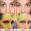 Wondrous Eye Essence Snail Cream Dark Circle and Eye Wrinkle Remover
